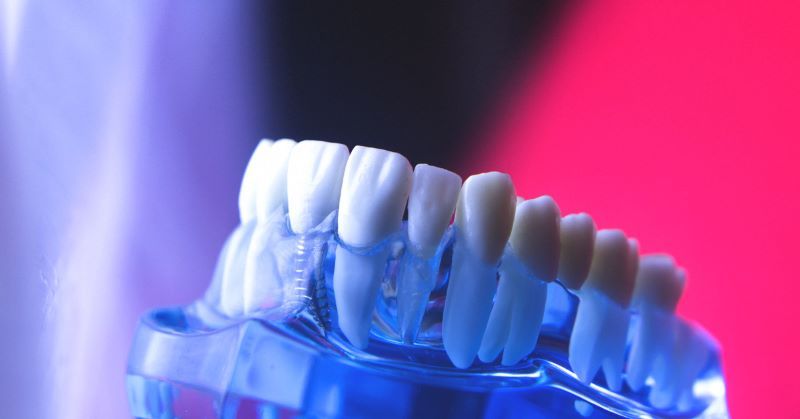 địa chỉ trồng răng implant tốt uy tín Phường Sài Gòn TPHCM 4