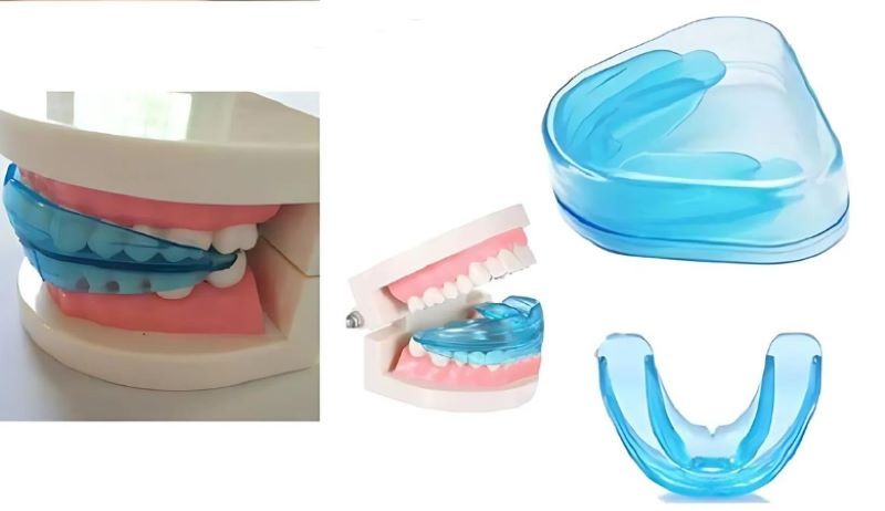 Hàm Trainer cho trẻ em 8