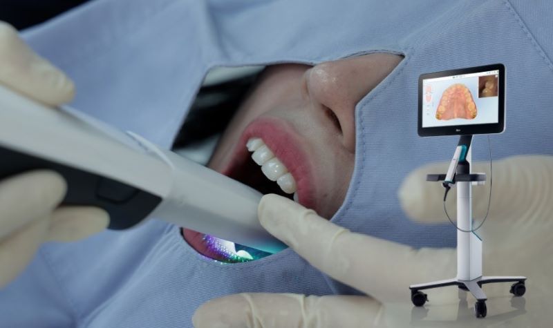 nha khoa trồng răng implant giá rẻ tốt uy tín Phường Tân Sơn Nhì TP HCM 4