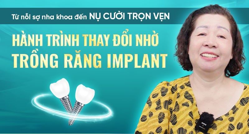 địa chỉ trồng răng implant tốt uy tín Phường Bến Thành TPHCM