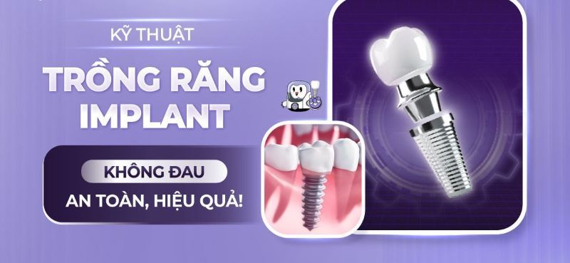 địa chỉ trồng răng implant tốt uy tín Phường Bến Thành TPHCM 7