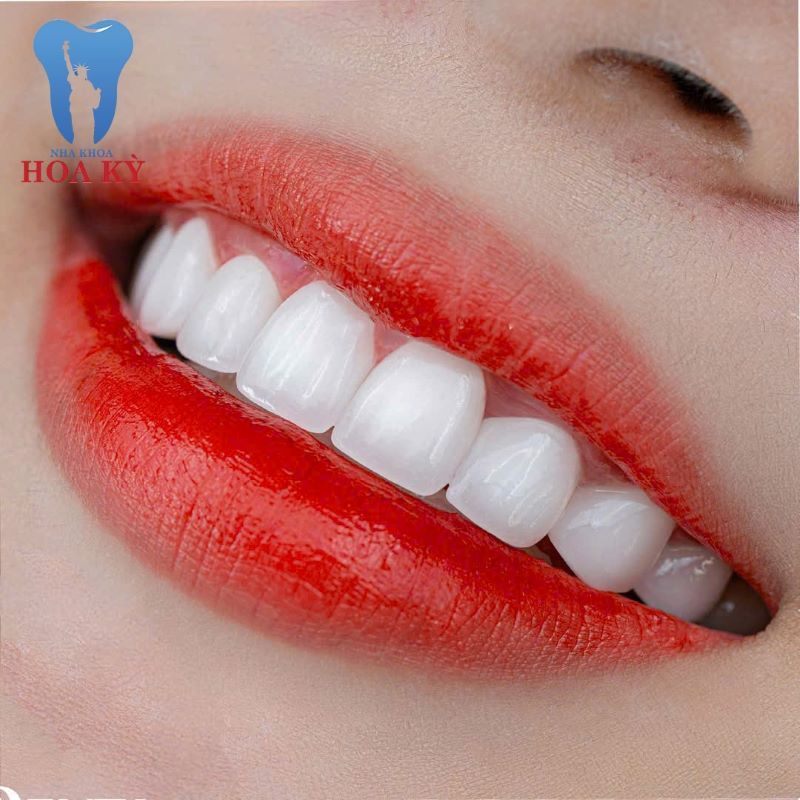 nha khoa bọc răng sứ giá rẻ tốt uy tín Phường Bình Tân TP HCM 5