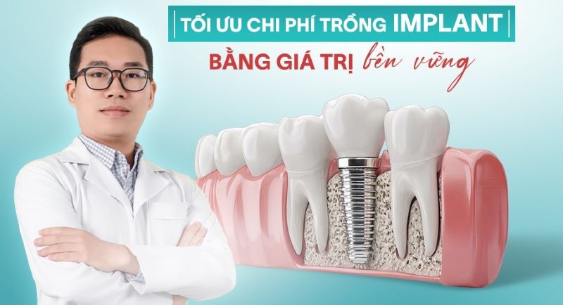 địa chỉ trồng răng implant tốt uy tín Phường Cầu Ông Lãnh TPHCM 2