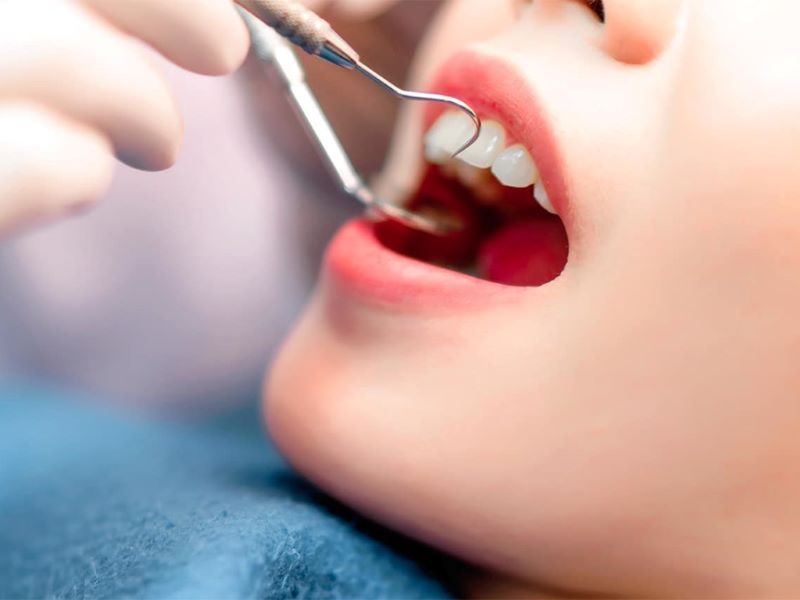 nha khoa trồng răng sứ giá rẻ tốt uy tín Phường Tân Sơn Nhì TP HCM 6