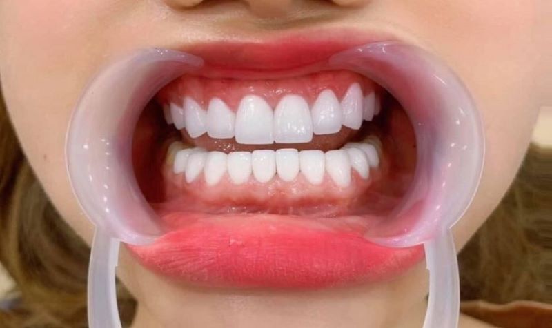 nha khoa trồng răng sứ giá rẻ tốt uy tín tại Quận Tân Phú