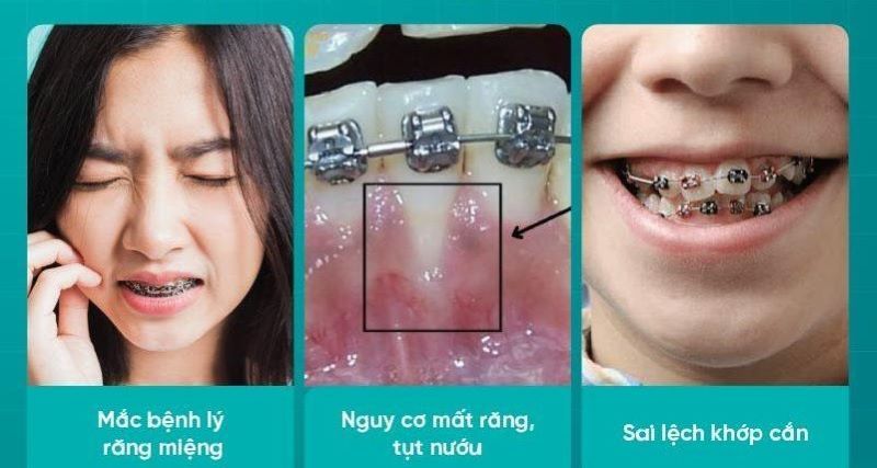 nha khoa niềng răng giá rẻ tốt uy tín Phường Bình Tân TP HCM
