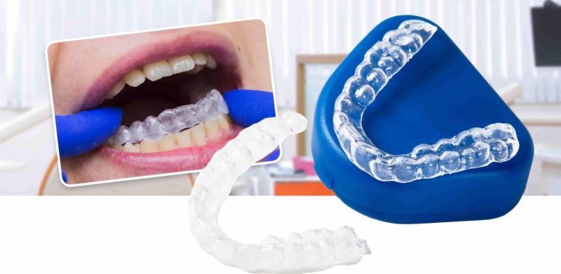 nha khoa niềng răng giá rẻ tốt uy tín tại Quận Tân Phú