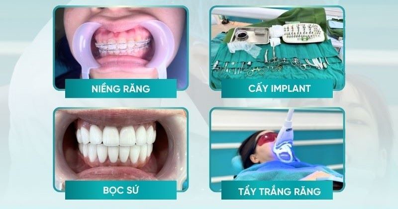 Top 5 nha khoa uy tín phường Bàn Cờ TPHCM 6