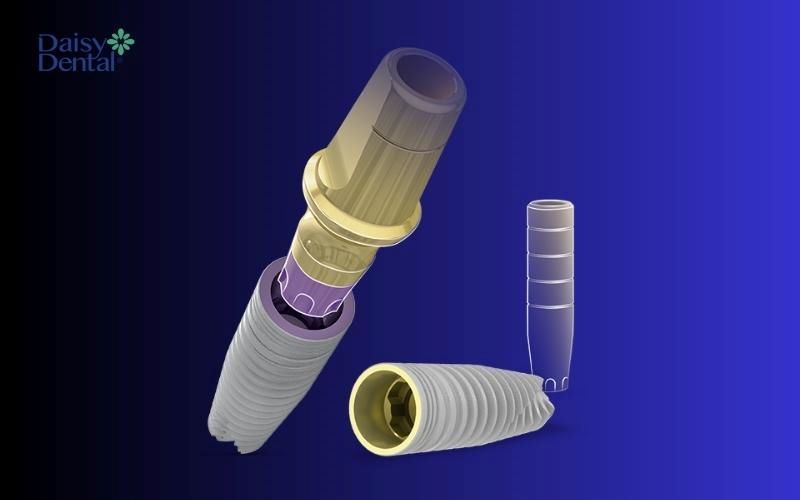 Nha khoa Tâm Như sử dụng Implant châu Âu chính hãng