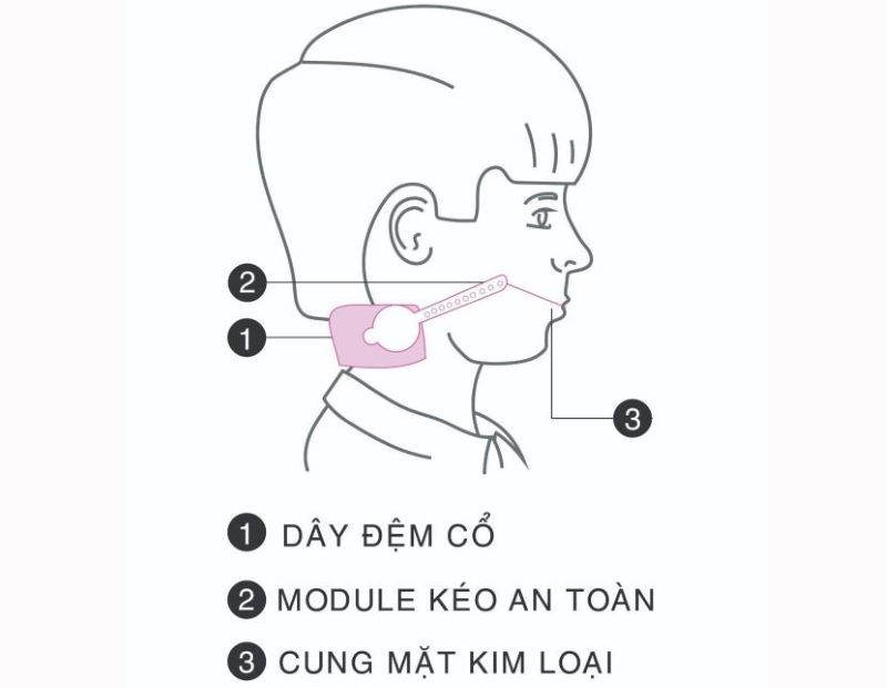 Khí cụ Headgear 2