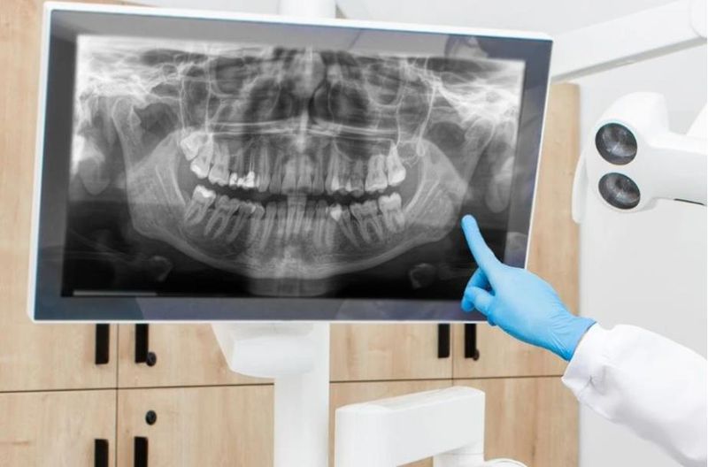 Bác sĩ tại Mỹ Kim đang kiểm tra phim CT trước nhổ răng khôn cho khách