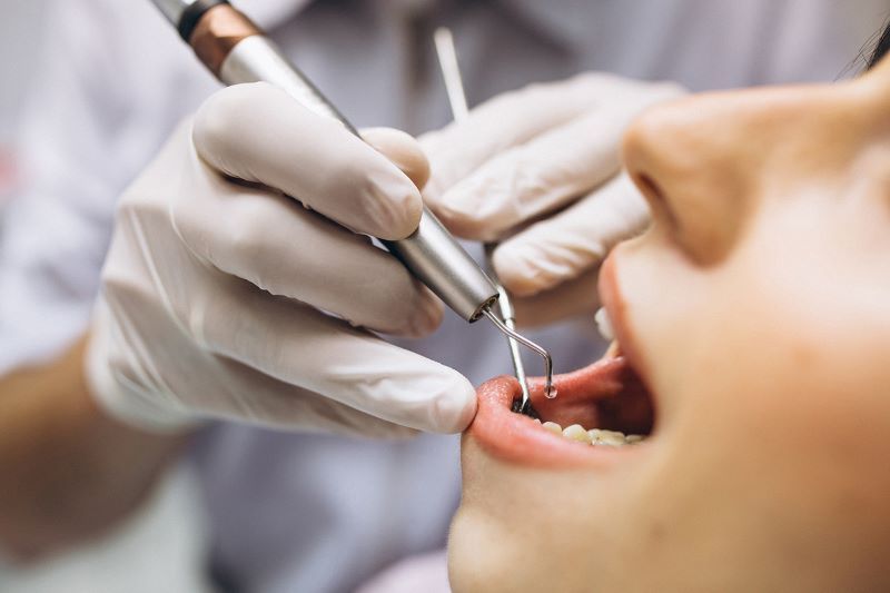 nha khoa nhổ răng khôn giá rẻ tốt uy tín Phường Tân Sơn Nhì TP HCM 5