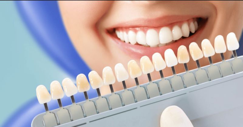 nha khoa tẩy trắng răng giá rẻ tốt uy tín Phường Bình Tân