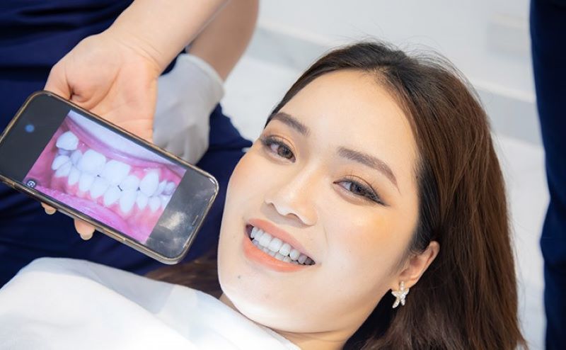 nha khoa tẩy trắng răng giá rẻ tốt uy tín Phường Tân Sơn Nhì TP HCM 3