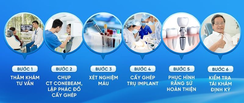địa chỉ trồng răng implant tốt uy tín Phường Xóm Chiếu TPHCM