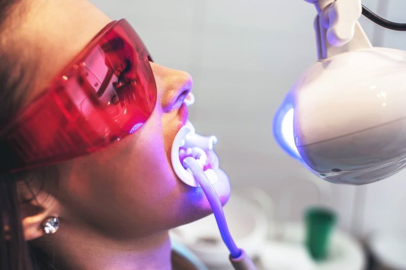 Nha khoa Anh Dental ứng dụng kỹ thuật tẩy trắng răng với công nghệ LED mới
