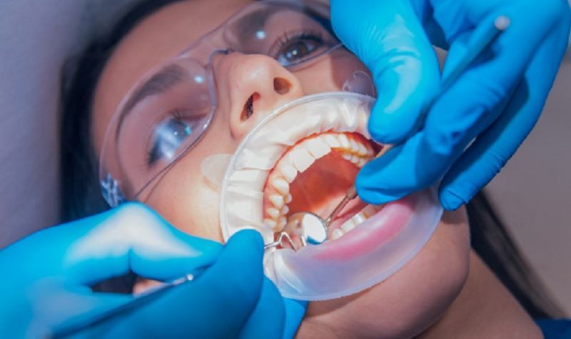 nha khoa điều trị tủy giá rẻ tốt uy tín Phường Bình Tân TP HCM 3