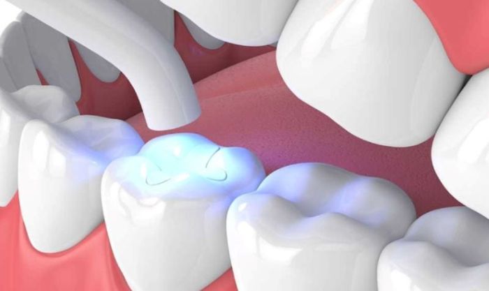 nha khoa trám răng giá rẻ tốt uy tín tại Bình Tân 2