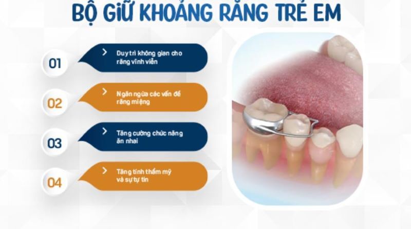 bộ giữ khoảng 3