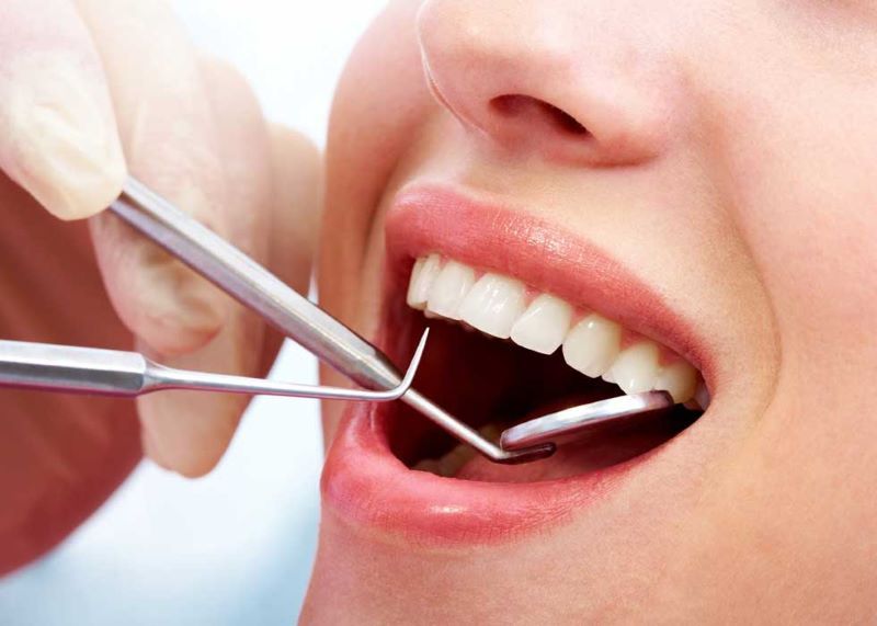 nha khoa cạo vôi răng giá rẻ tốt uy tín Phường Bình Tân TP HCM 2