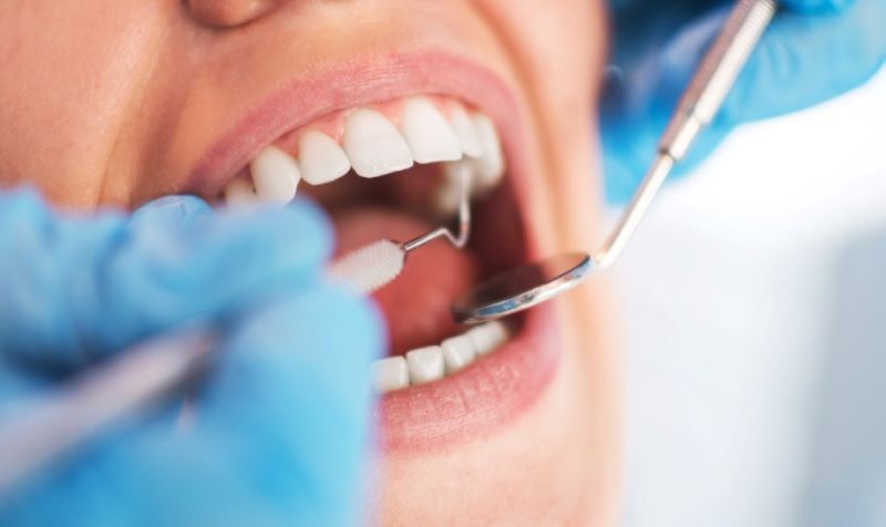 Bác tiến hành cạo vôi răng nhẹ nhàng cho khách hàng.