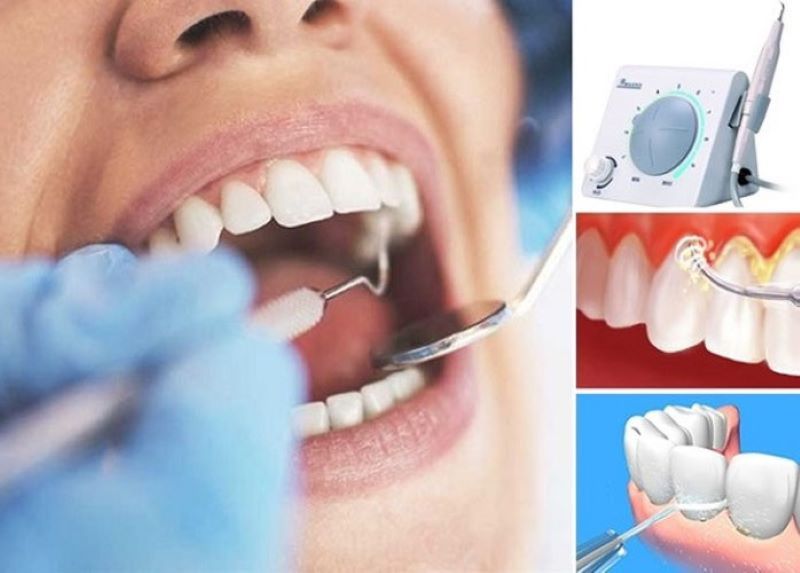 nha khoa cạo vôi răng giá rẻ tốt uy tín tại Quận Tân Phú 2