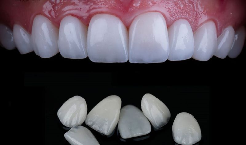 nha khoa uy tín Phường Tân Hải TPHCM 4