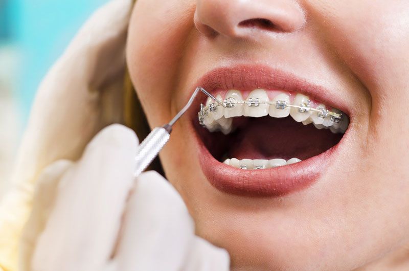 nha khoa uy tín Phường Phú Mỹ TPHCM 2