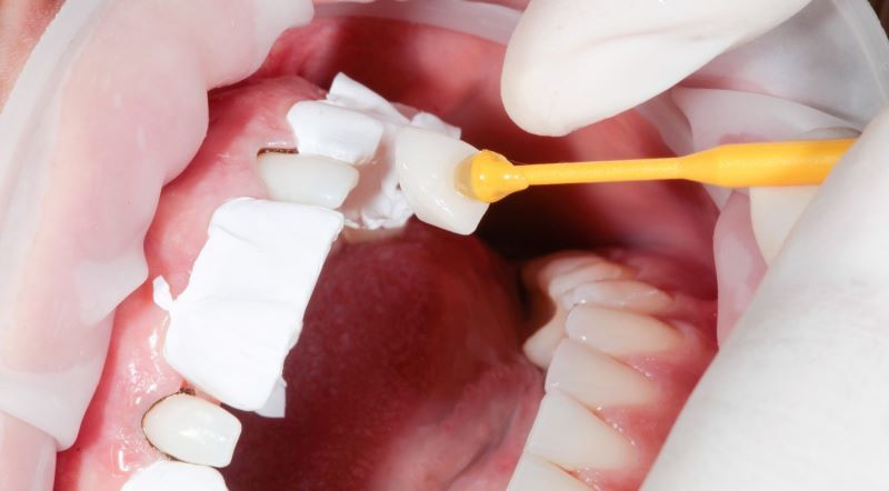 nha khoa uy tín Phường Tân Thành TPHCM 2