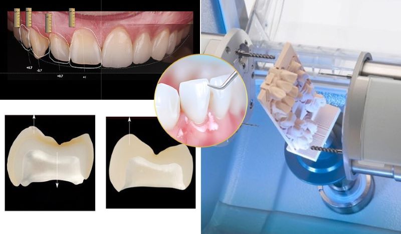 Nha khoa Việt Mỹ sở hữu hệ thống labo răng sứ riêng biệt, hiện đại