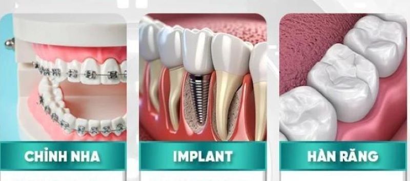 nha khoa uy tín Xã Tân Vĩnh Lộc TPHCM 7