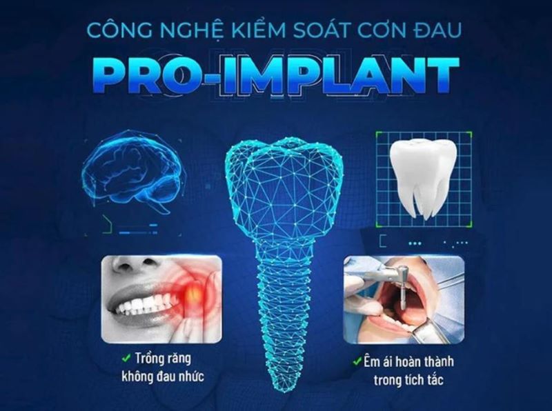 địa chỉ trồng răng implant tốt uy tín Phường An Đông TPHCM