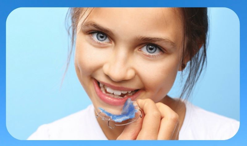 chỉnh nha sớm cho trẻ