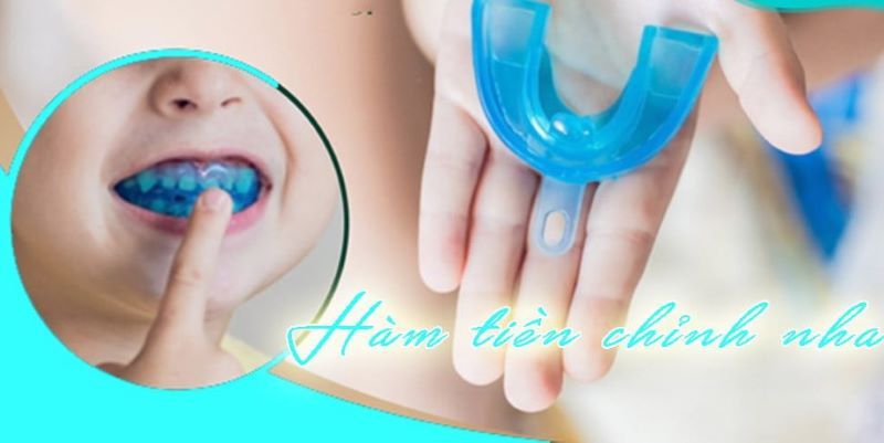 chỉnh nha sớm cho trẻ 4
