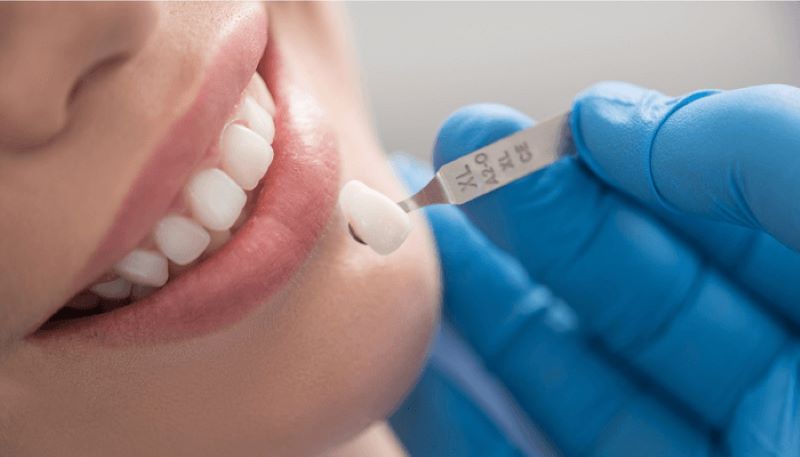 nha khoa uy tín xã Nhuận Đức TPHCM 7