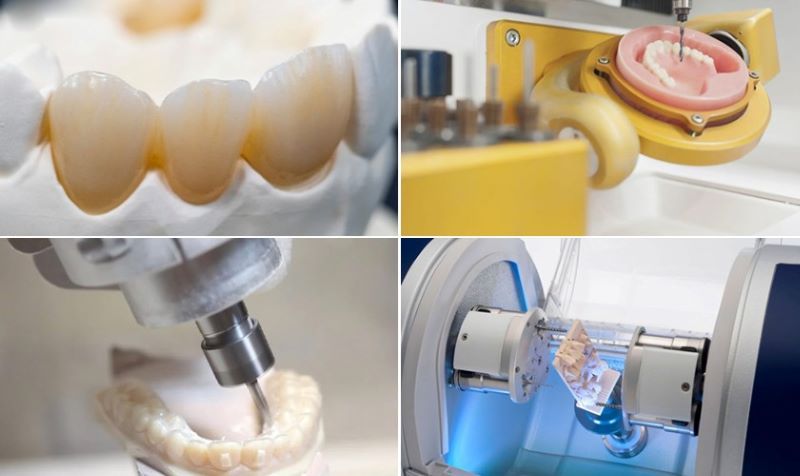 Nha khoa Mỹ Ý công nghệ CAD CAM phục hình chính xác