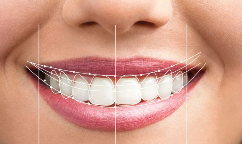 nha khoa uy tín xã Bình Mỹ TPHCM 3