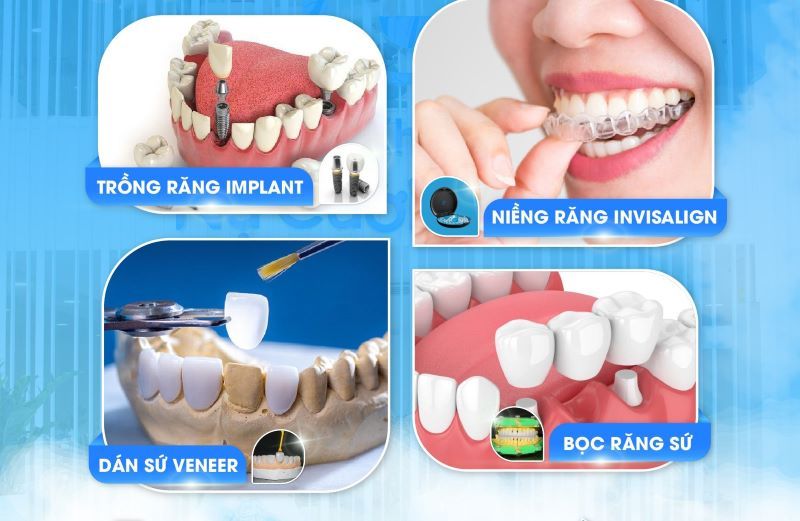 nha khoa uy tín xã Hóc Môn TPHCM 2