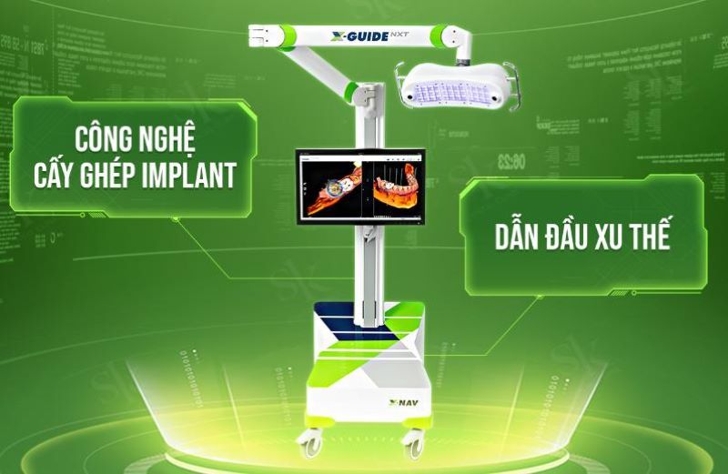 Nha khoa Thành Vinh nổi bật với dịch vụ implant hiện đại