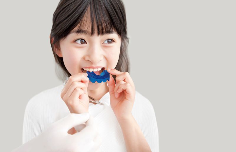 Chỉnh nha sớm cho bé 2