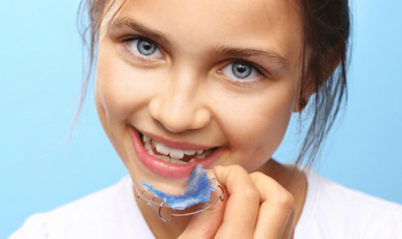 Chỉnh nha sớm cho bé 4