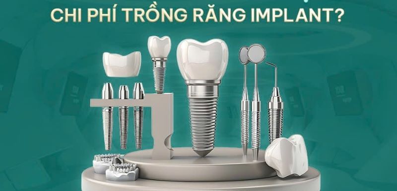 địa chỉ trồng răng implant tốt uy tín Phường Bình Tây TPHCM 2