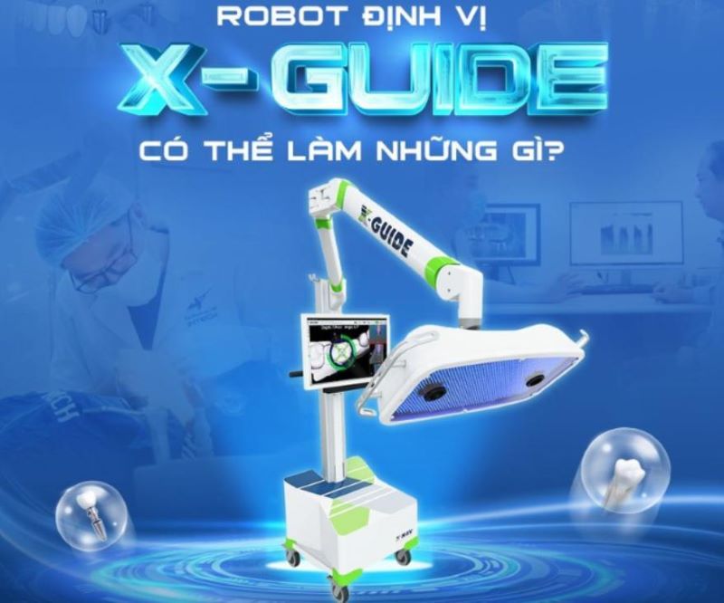Nha khoa Lạc Việt Intech ứng dụng Robot X-Guide tiên tiến