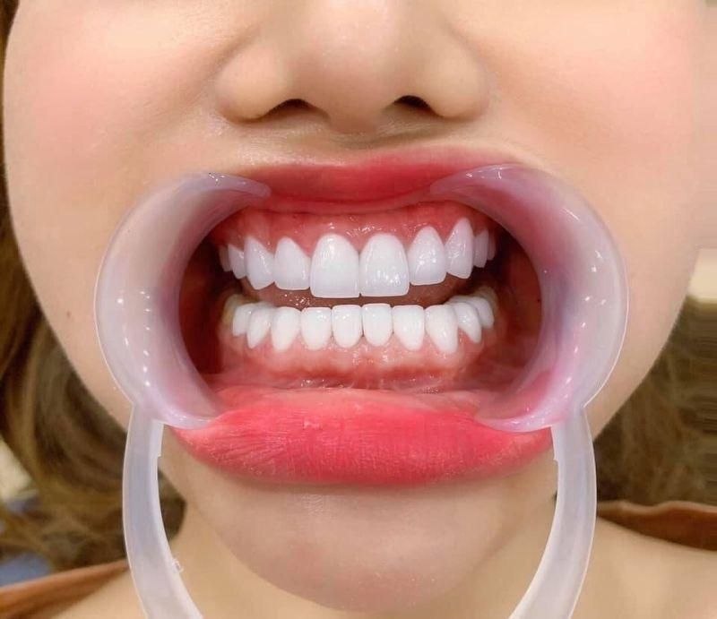 nha khoa uy tín xã Thường Tân TPHCM 9