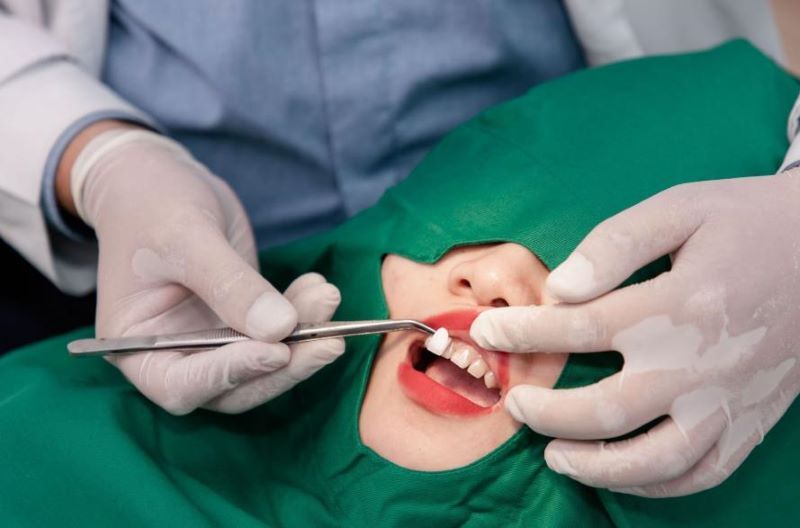 Nha khoa Nam Đô phục hình răng sứ thẩm mỹ cao
