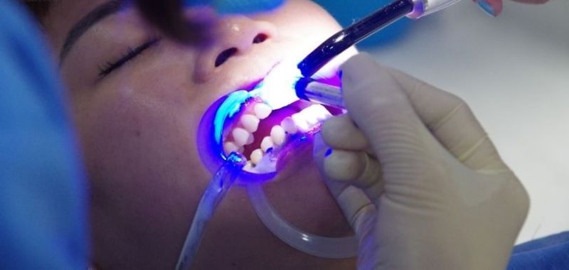 nha khoa uy tín xã Phước Thành TPHCM 2