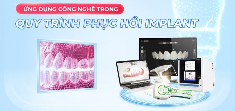 Nha khoa Đại Nam ứng dụng công nghệ Implant tiên tiến