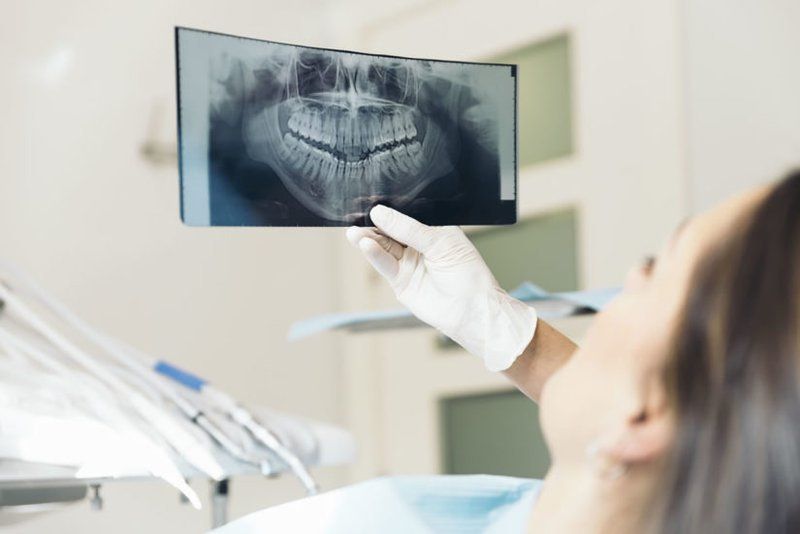 Nha khoa Khánh Minh II ứng dụng X-Quang kỹ thuật số