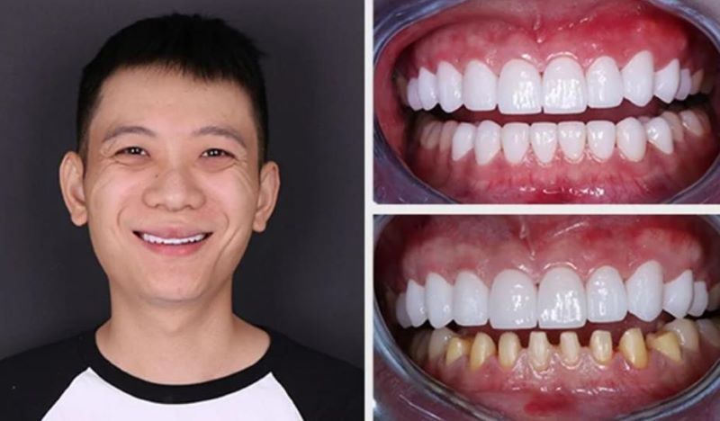 nha khoa uy tín xã Minh Thạnh TPHCM 3