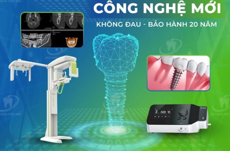 địa chỉ trồng răng implant tốt uy tín Phường Bình Phú TPHCM